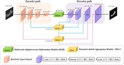 MF-Net: Multi-Scale Information Fusion Network for CNV Segmentation in Retinal OCT Images